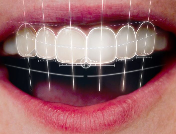 59-Gülüş Tasarımının Dijital Dönüşümü: Estetik Diş Hekimliğinde Yenilikçi Yaklaşım